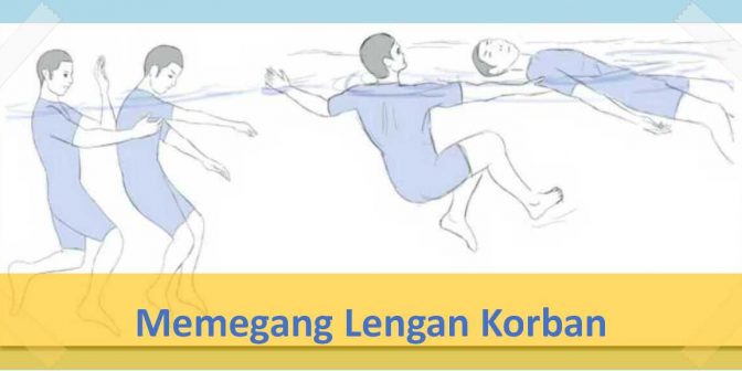 Memegang lengan korban