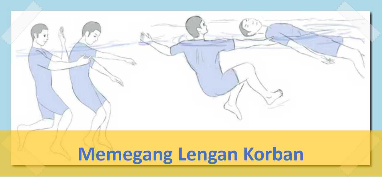 Memegang lengan korban