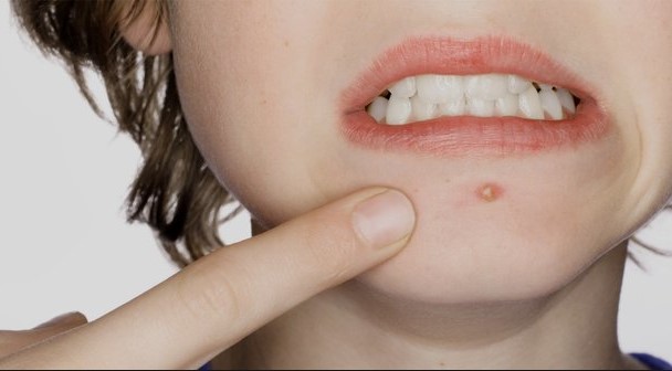 manfaat berendam air belerang