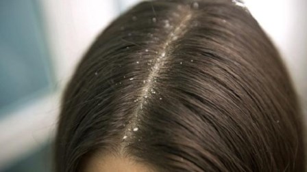 manfaat berendam air belerang