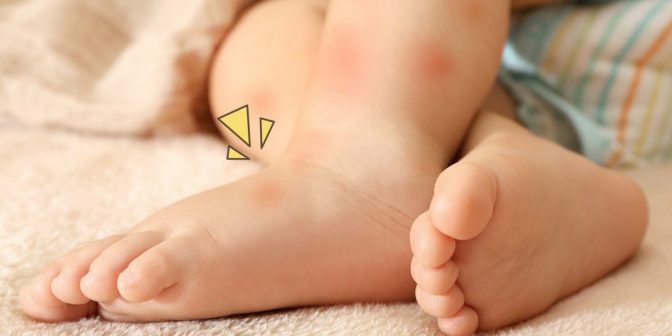 mencegah alergi pada anak