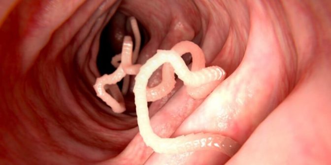 Produk Obat untuk Mengatasi Cacingan pada Anak 