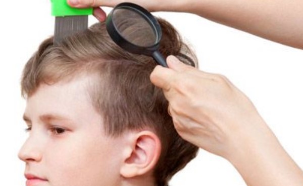 kutu rambut pada anak