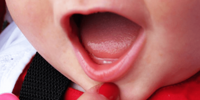 Gigi Tumbuh Pada Bayi