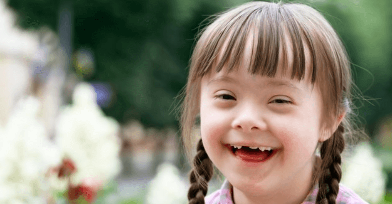 anak-berkebutuhan-khusus-2