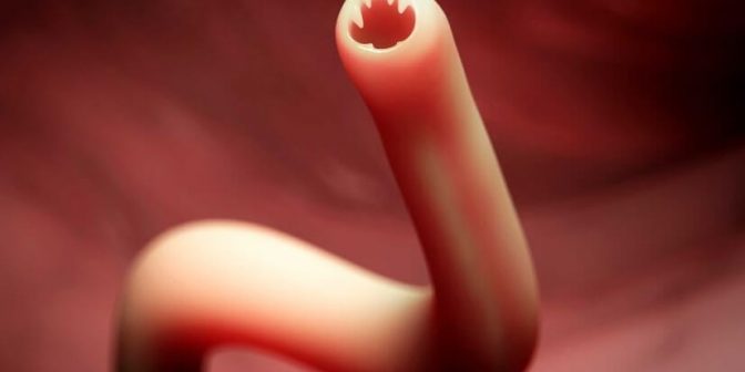 anak sering cacingan