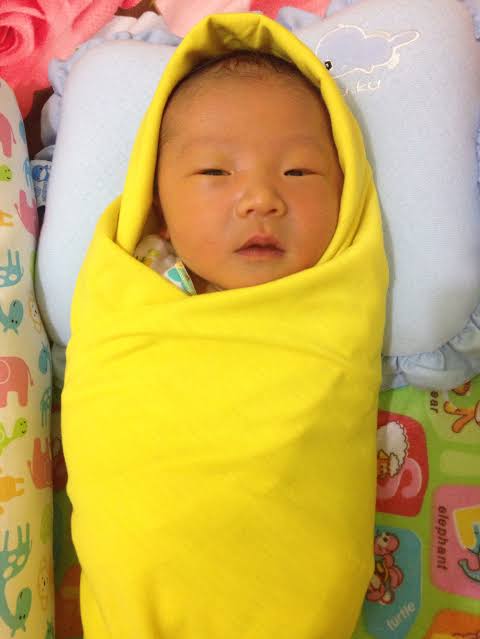 Resiko bayi kuning