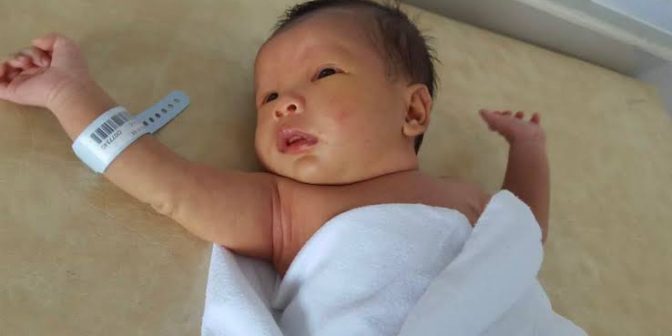 Cara menangani bayi kuning