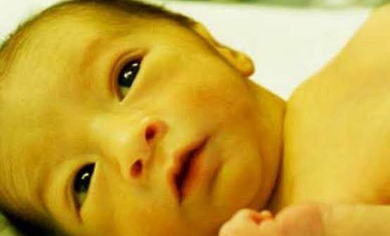 Bayi Kuning