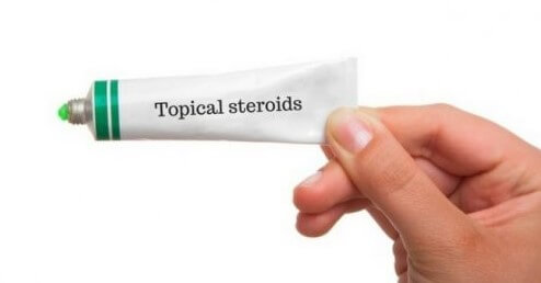 Salep Kortikosteroid