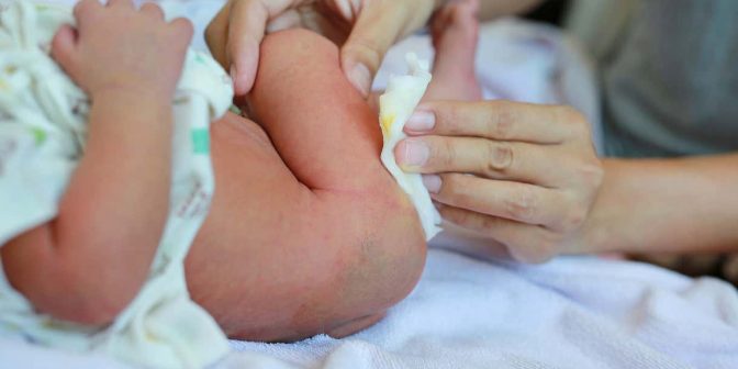 Penyebab Bayi Tidak BAB