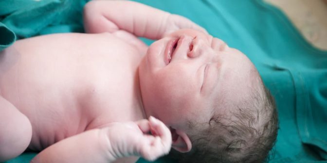 bayi lahir tidak menangis