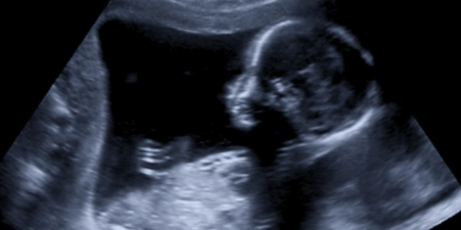 usg kehamilan cnparenting.com