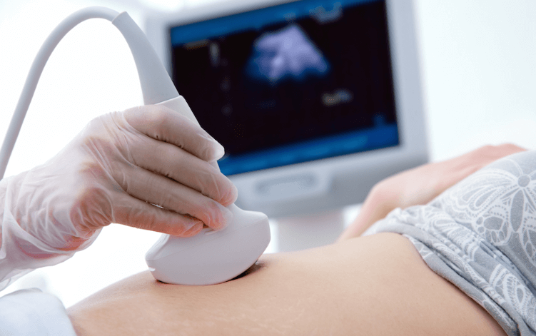 usg kehamilan