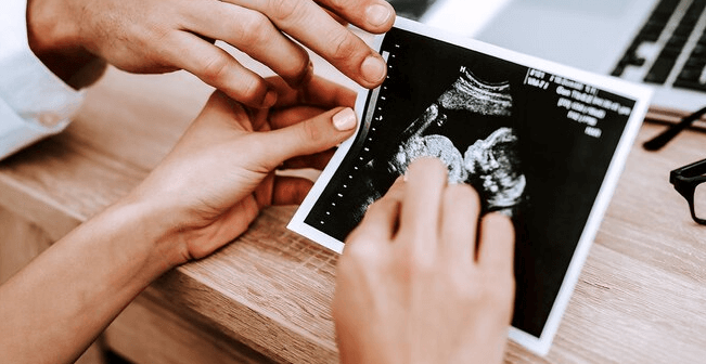 Waktu terbaik cek kehamilan