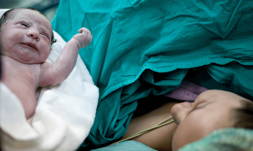 Bekas Jahitan Caesar