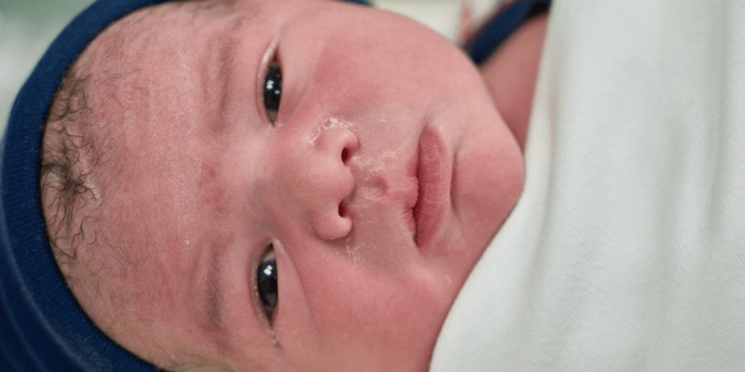 hidung bayi tersumbat