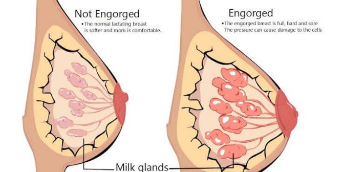 Tanda Seminggu Setelah Melahirkan 