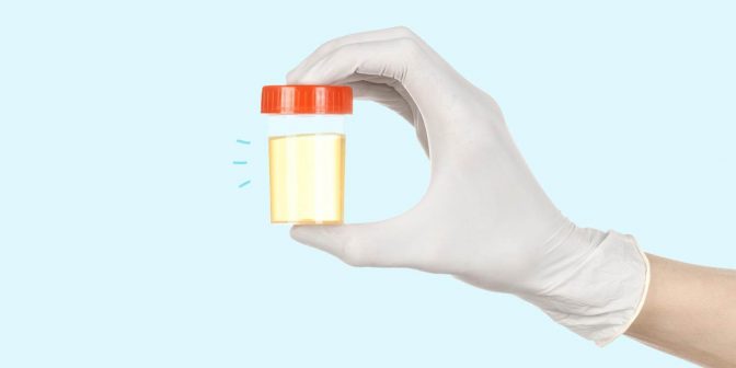 Hasil Tespek Positif 