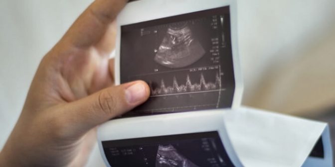 kehamilan kosong via 1