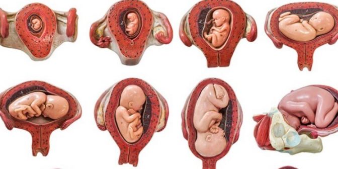 posisi bayi dalam kandungan