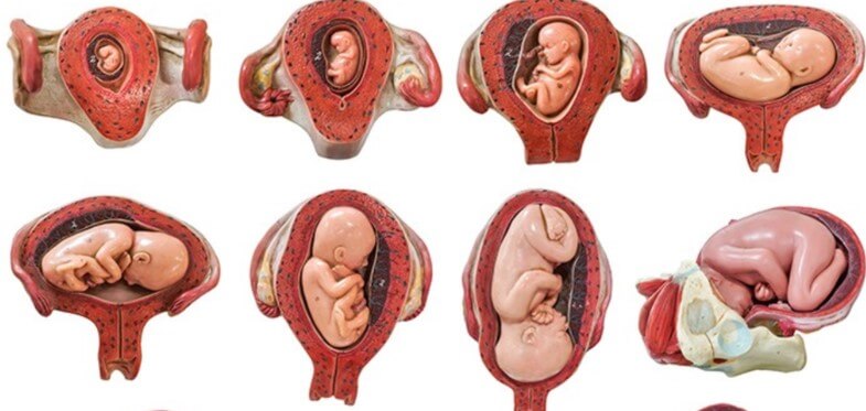 posisi bayi dalam kandungan