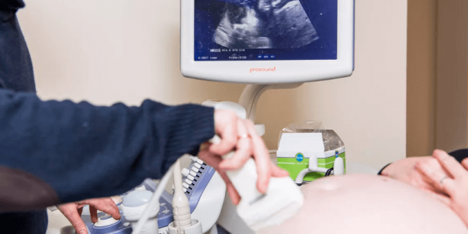 usia kehamilan normal