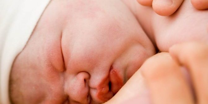 Melahirkan Normal setelah Caesar