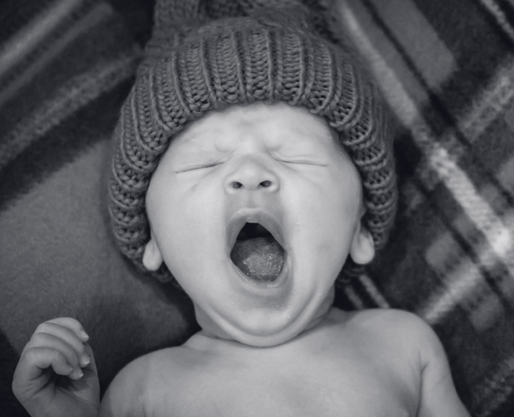 botulisme pada bayi