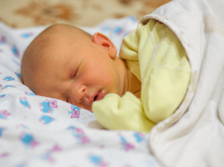 Penyakit Kuning pada Bayi