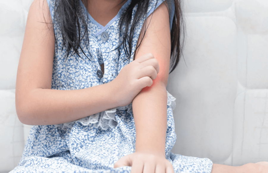 Jenis Penyakit Kulit pada Anak