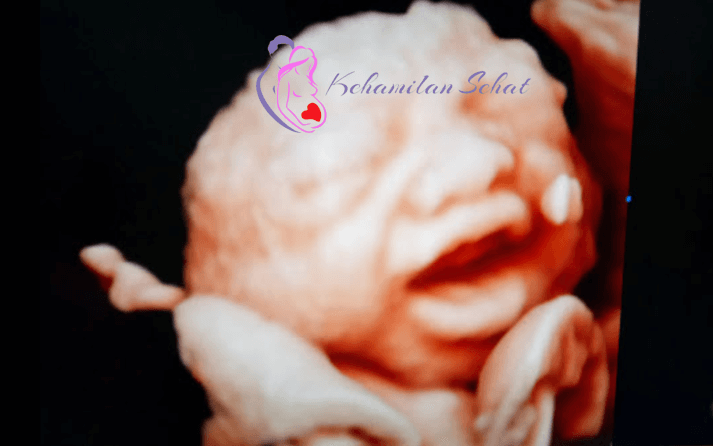 kehamilan sehat poris