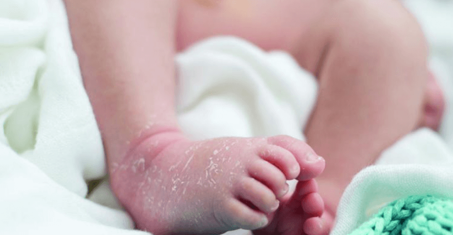 Kulit Kering pada Bayi