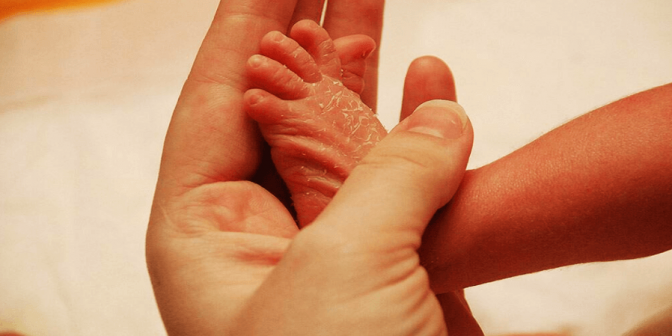 Kulit Kering pada Bayi