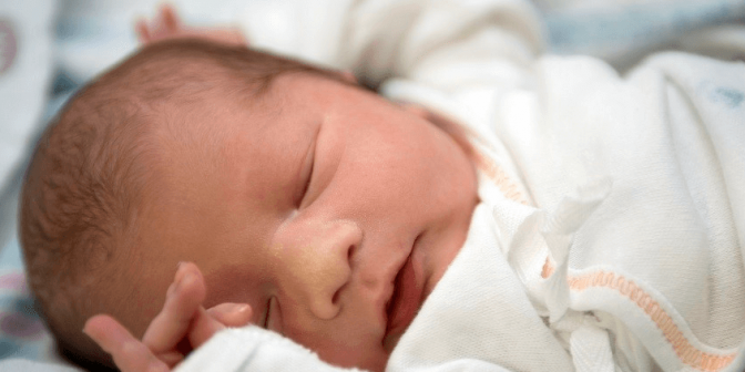 Penyakit Kuning pada Bayi