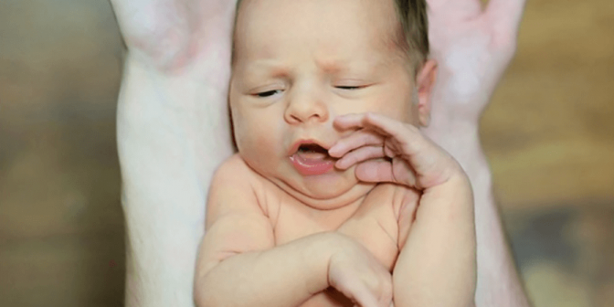 Penyakit Kuning pada Bayi