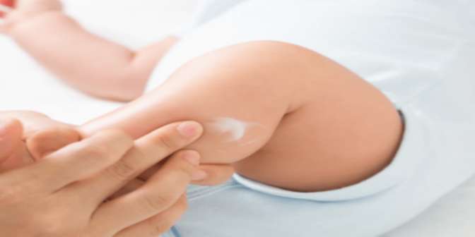 Perawatan Kulit Bayi Sensitif