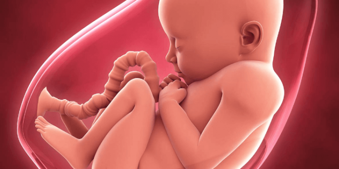 Polihidramnion pada Janin