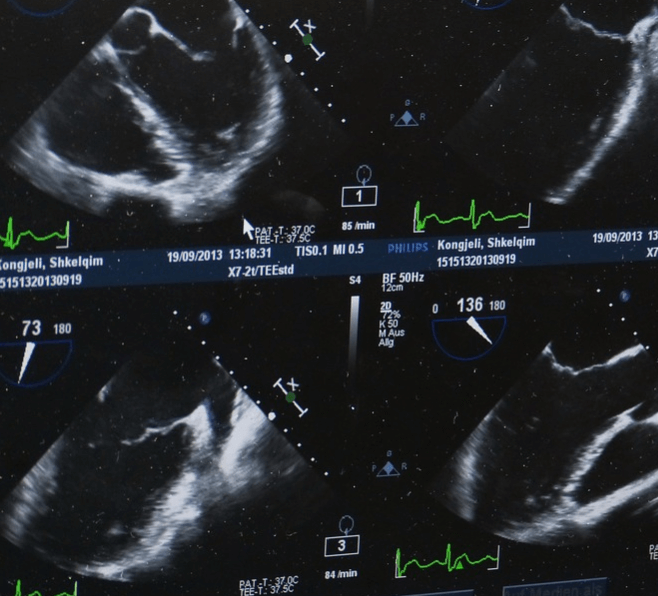 cara membaca hasil USG