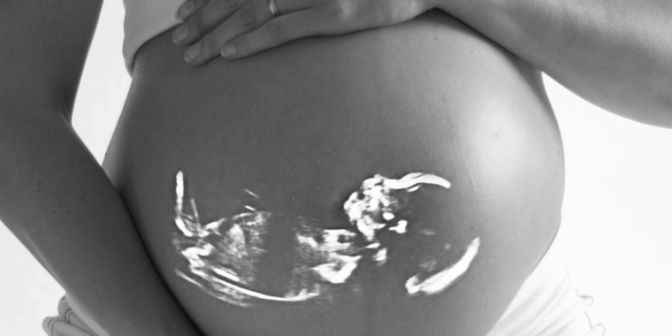 cara membaca hasil USG