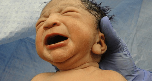 allergic march pada bayi