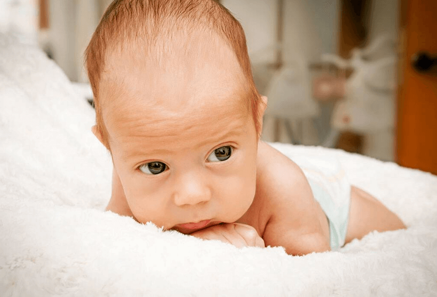 Bayi Baru Lahir Jarang Pipis