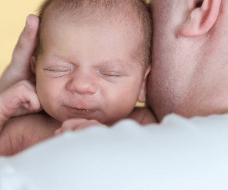 biduran pada bayi