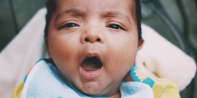 Bibir Hitam pada Bayi