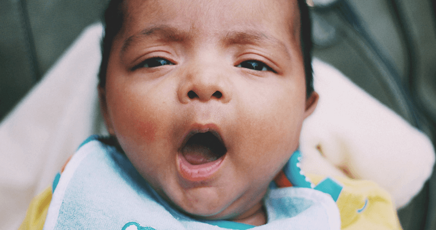 Bibir Hitam pada Bayi