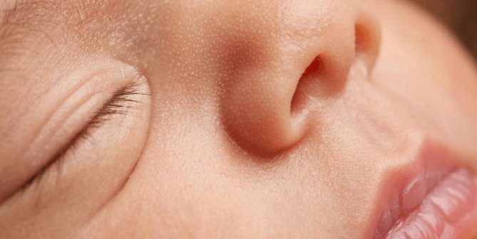 Bibir Hitam pada Bayi