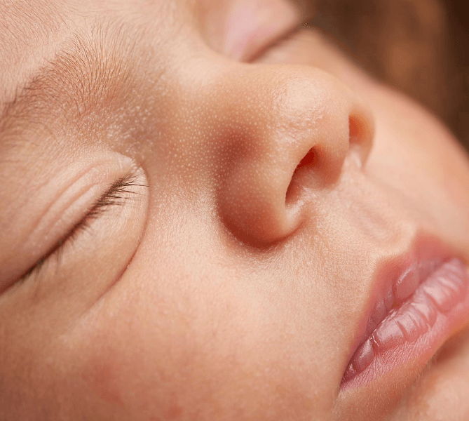 Bibir Hitam pada Bayi