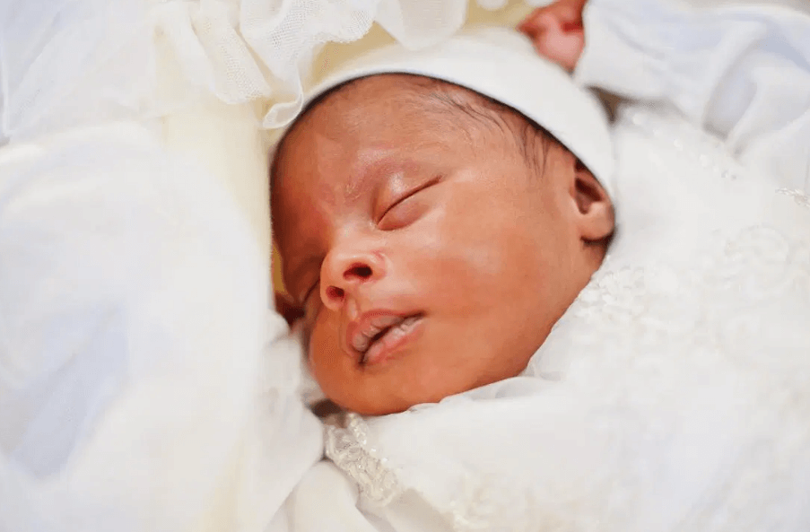 Bibir Hitam pada Bayi