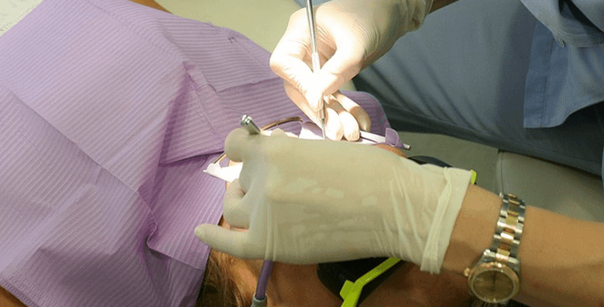 tambal gigi saat hamil