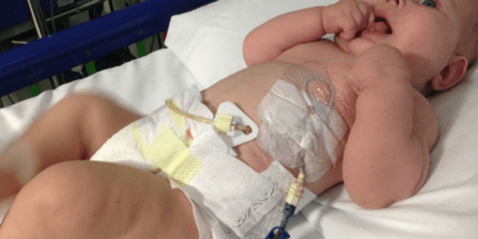 Kelainan Ginjal pada Bayi